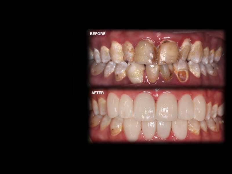 SMILE MAKEOVER DENTIST