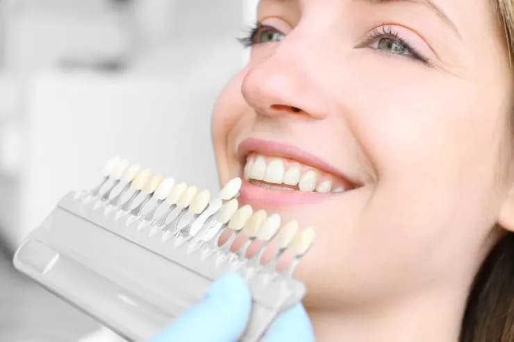 Ceramic Veneers in Valsad Ceramic Veneers in Valsad