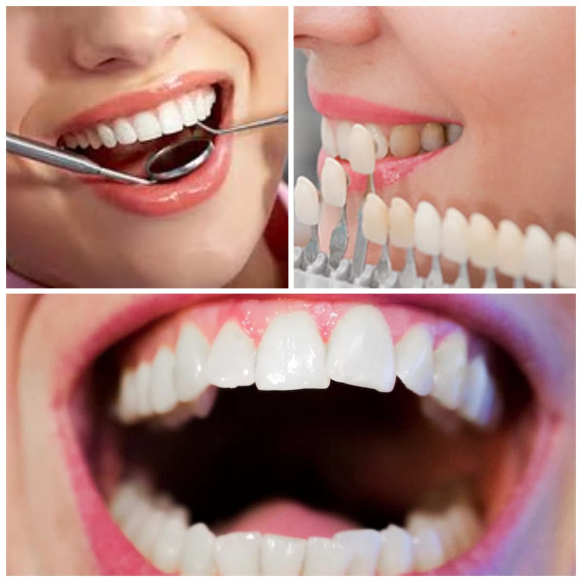 Complete Smile Transformation in Valsad Complete Smile Transformation in Valsad